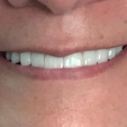 Bob Perkins, DDS - Smiles in Malibu - My Favorite beautiful Smile