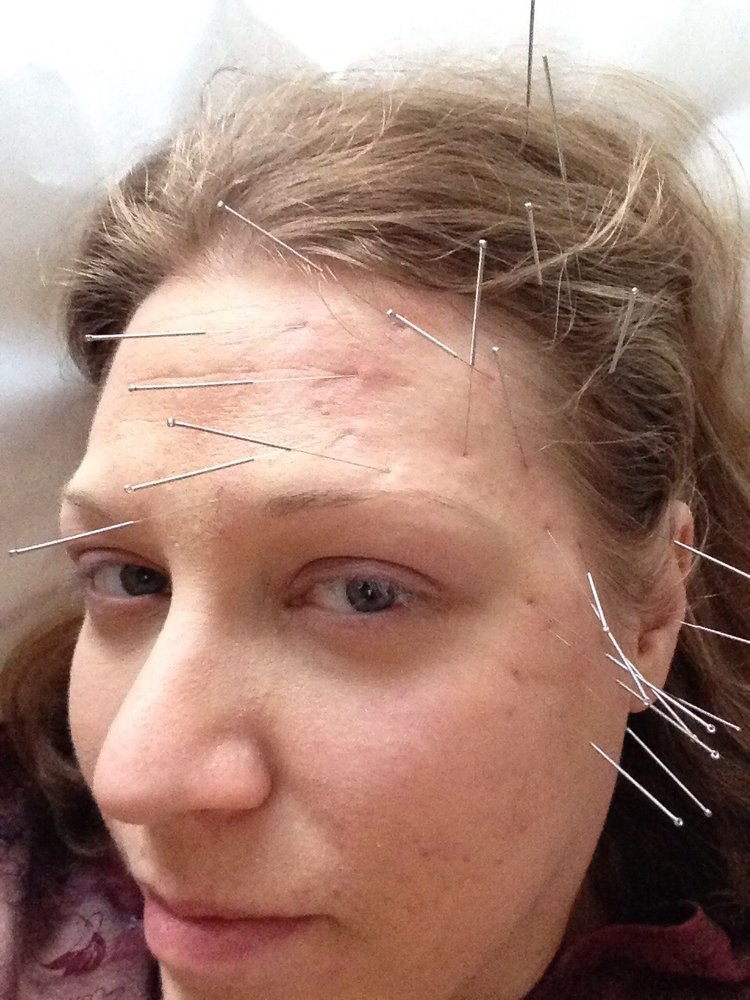 ACUPUNCTURE & CHINESE HERB CENTER Updated August 2024 206 N