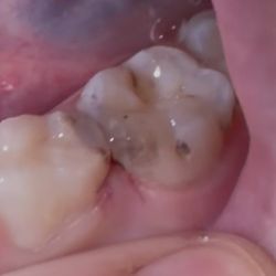 Hendricks Pediatric Dentistry