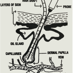 Donna Llamas Electrology - How Electrolysis Works!