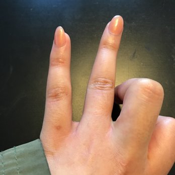 DK Diamond Nails - My pinky nail is seriously crooked. - Nail Salons Near Me - Saint Louis Park, Minnesota DK Diamond Nails - My pinky nail is seriously crooked. - Nail Salons Near Me - Saint Louis Park, Minnesota