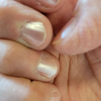 Euro Nails - This is what I paid for!! - Nail Salons Near Me - Martinsburg, West Virginia Euro Nails - This is what I paid for!! - Nail Salons Near Me - Martinsburg, West Virginia