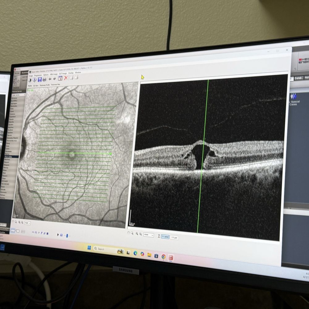 Nevada Retina Center - Retina Specialists Near Me - Henderson, Nevada