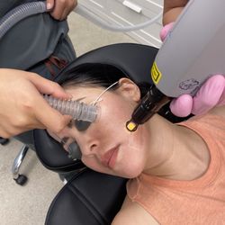The Skin Queue Aesthetics Medical Spa - Getting Laser Resurfacing! Literally almost fell asleep during the treatment