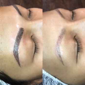Exquisite Aesthetics - Skin Care Near Me - Redondo Beach, California Exquisite Aesthetics - Skin Care Near Me - Redondo Beach, California