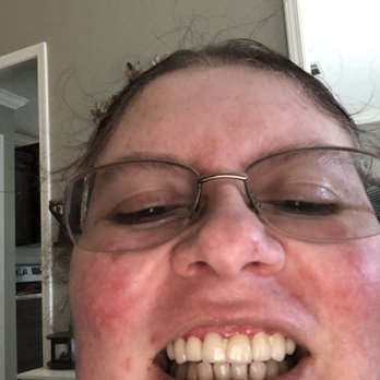 Aspen Dental - Jackson, TN - Permanent Crowns-not white, not pretty! - Oral Surgeons Near Me - Jackson, Tennessee