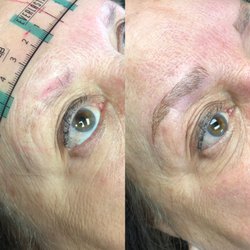 Alexa Faye Beauty - Before and after. First session.