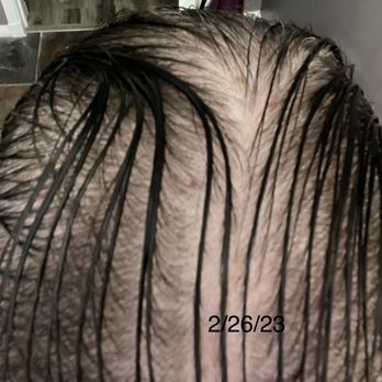 Salon Adair - My hair loss February 2023! Sooo much worse than when I started going to Salon Adair! - Hair Salons Near Me - Carlsbad, California Salon Adair - My hair loss February 2023! Sooo much worse than when I started going to Salon Adair! - Hair Salons Near Me - Carlsbad, California