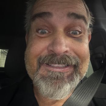 Bionic Smile - Bruising and swelling - Cosmetic Dentists Near Me - Las Vegas, Nevada