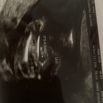 Baby Bump Studios - It's a Girl - Ultrasound Imaging Centers Near Me - Moreno Valley, California Baby Bump Studios - It's a Girl - Ultrasound Imaging Centers Near Me - Moreno Valley, California