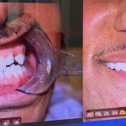 Before and After Before and After