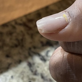 Serenity Nails And Spa - Dip manicure nail chip one week after getting nails done - Nail Salons Near Me - Waldorf, Maryland Serenity Nails And Spa - Dip manicure nail chip one week after getting nails done - Nail Salons Near Me - Waldorf, Maryland