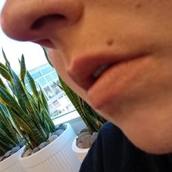 The Plastic Surgery Group - This is my BEFORE.... Top lip THIN and bottom lip kinda thin .....