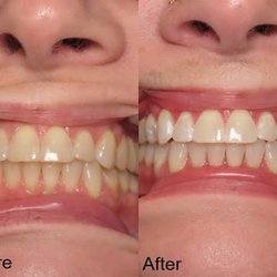 Capital Springs Orthodontics