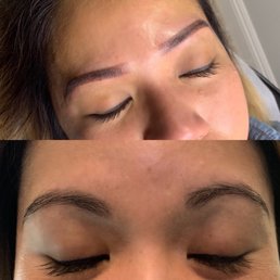 Before and After
