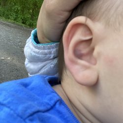 Goose & Gander Preschools - Adult THUMB PRINT bruise in baby's ear!!! Pediatrician verified!!