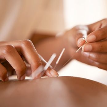 Norfolk Acupuncture - Massage Near Me - Norfolk, Virginia Norfolk Acupuncture - Massage Near Me - Norfolk, Virginia
