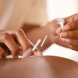 Norfolk Acupuncture