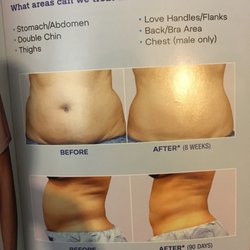 Ideal Image North Andover