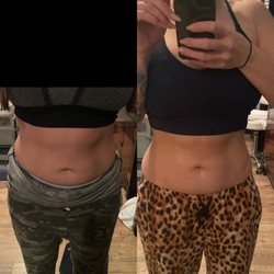 Reshape California Body Contour