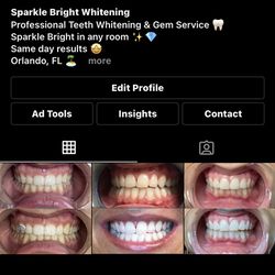 Sparkle Bright Whitening - Follow our following @sparklebrightwhiteningllc
