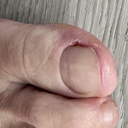 Crystal Nails - Do not go to this place! Terrible pedicure!  My toes are still bleeding 4 days after the pedicure.