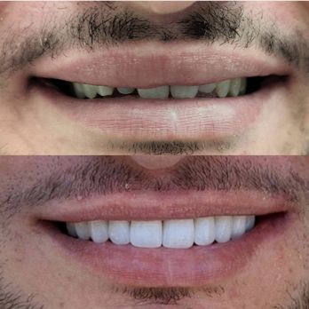 Thi Minh Nguyen, DMD - General Dentistry Near Me - Garden Grove, California Thi Minh Nguyen, DMD - General Dentistry Near Me - Garden Grove, California