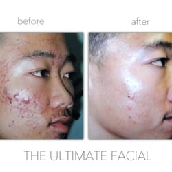 The Ultimate Facial