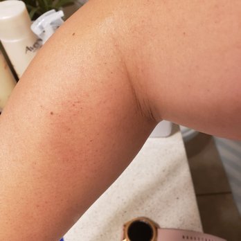 Dolce Bella Spa - My arm - Day Spas Near Me - Tijuana, BCN Dolce Bella Spa - My arm - Day Spas Near Me - Tijuana, BCN