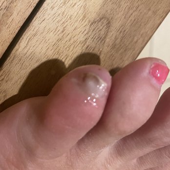Bella Nail Spa - 9/13/21. Removed the polish to see what was underneath. Not sure if that's blood from the drainage or fungus. F&@$! - Nail Salons Near Me - San Ramon, California Bella Nail Spa - 9/13/21. Removed the polish to see what was underneath. Not sure if that's blood from the drainage or fungus. F&@$! - Nail Salons Near Me - San Ramon, California