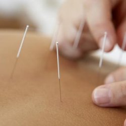 Todd Mccloskey Acupuncture