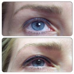 Cos-Med Aesthetic Clinic - Eyeline correction