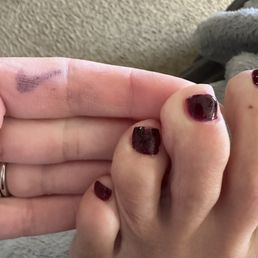 More horrible looking toes