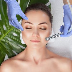 Vela Beauty Lab - Microdermabrasion