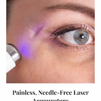 Kelly's Holistic - Laser therapy - Acupuncture Near Me - Hopatcong, New Jersey