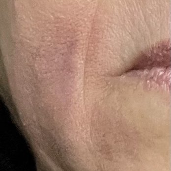 4EVER YOUNG ANTI AGING SOLUTIONS - Updated February 2026 - 28 Photos