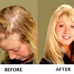 Peggy Tom Hair Replacement