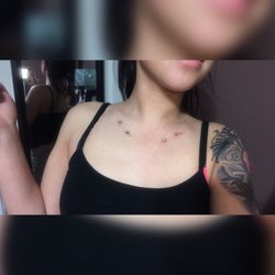Sacred Markings Tattoo & Body Piercings - Fresh Dermals by lorenzo & Yes they're Straight!