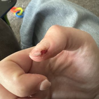 Wynn Nails & Hair - broken hurt nail - Nail Salons Near Me - Maricopa, Arizona