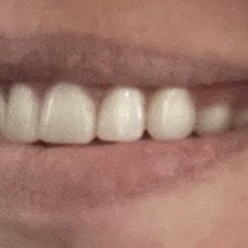Affordable Dentures & Implants - Denture - Cosmetic Dentists Near Me - Bullhead City, Arizona