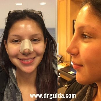 Robert Guida, MD - Cosmetic Surgeons Near Me - New York, New York Robert Guida, MD - Cosmetic Surgeons Near Me - New York, New York