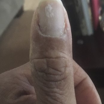 Miracle Nails - Gel manicure began peeling two days later. Pulled the color off. - Nail Salons Near Me - Clinton, Maryland