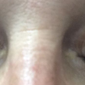 Le Nails - They don't even match with my eyes closed! Note the wayward adhesive on both eyelids. - Nail Salons Near Me - Lufkin, Texas Le Nails - They don't even match with my eyes closed! Note the wayward adhesive on both eyelids. - Nail Salons Near Me - Lufkin, Texas
