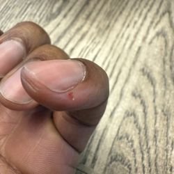 Gigi Nails - Cut finger