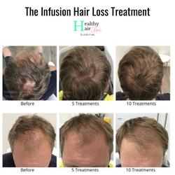 Healthy Hair Clinic