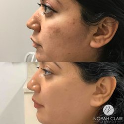Norah Clair Aesthetics - Chemical peel and medical grade skincare!