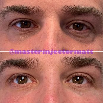Cimarron Aesthetics - Dermatologists Near Me - New Albany, Ohio Cimarron Aesthetics - Dermatologists Near Me - New Albany, Ohio