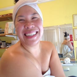 Vibrant Skin Care - After