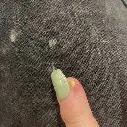 Marlene's Nails Spa - At doctors getting antibiotics saying that they need to remove those nails due to spreading