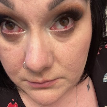 Milan Nails & Spa - The hemorrhage I have in my eye from being injured by their lash tech. - Nail Salons Near Me - Fresno, California